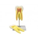 Modelo dental molar superior
