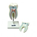 Modelo dental molar superior