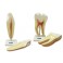 Modelo dental incisivo y molar